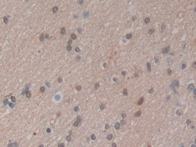 HSPA1A Antibody in Immunohistochemistry (Paraffin) (IHC (P))