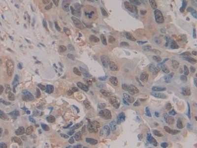HSPA1A Antibody in Immunohistochemistry (Paraffin) (IHC (P))