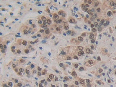 HSPA1A Antibody in Immunohistochemistry (Paraffin) (IHC (P))