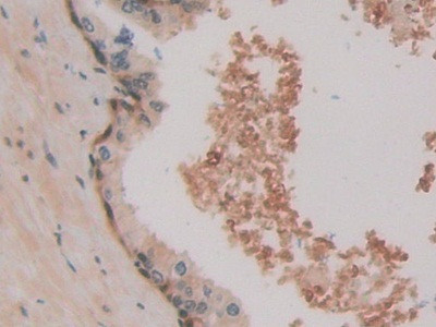 HSPA1A Antibody in Immunohistochemistry (Paraffin) (IHC (P))