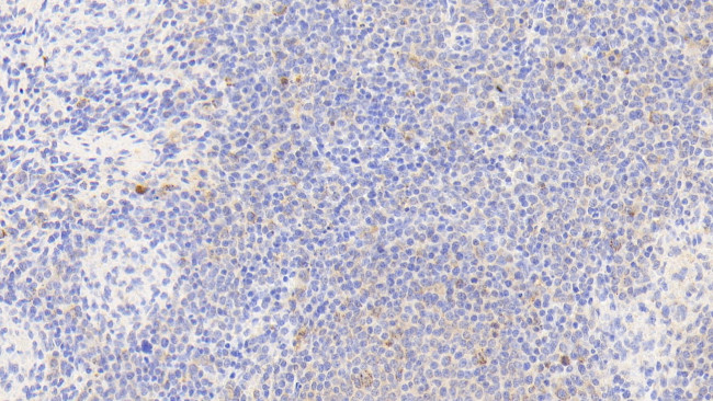 HSP60 Antibody in Immunohistochemistry (Paraffin) (IHC (P))