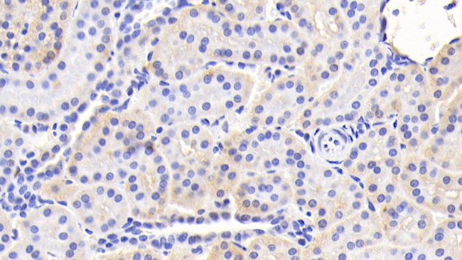 HFE2 Antibody in Immunohistochemistry (Paraffin) (IHC (P))