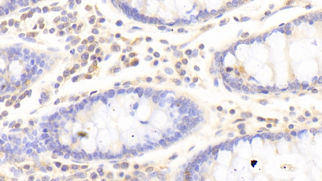 HPa1 Antibody in Immunohistochemistry (Paraffin) (IHC (P))