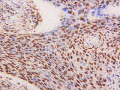 hnRNP A2B1 Antibody in Immunohistochemistry (Paraffin) (IHC (P))