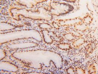 hnRNP A2B1 Antibody in Immunohistochemistry (Paraffin) (IHC (P))