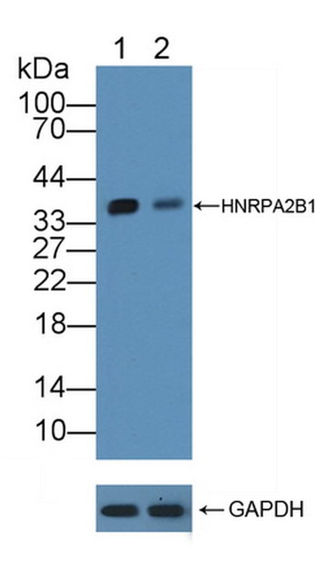 hnRNP A2B1 Antibody in Western Blot (WB)