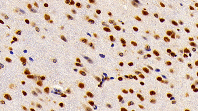 HMGB1 Antibody in Immunohistochemistry (Paraffin) (IHC (P))