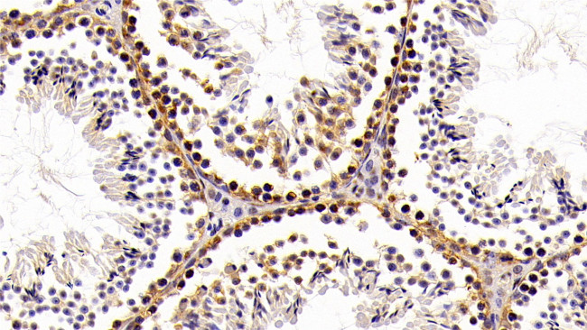 HMGB1 Antibody in Immunohistochemistry (Paraffin) (IHC (P))