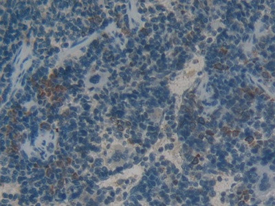 HMGB1 Antibody in Immunohistochemistry (Paraffin) (IHC (P))