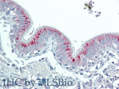 HAO1 Antibody in Immunohistochemistry (Paraffin) (IHC (P))