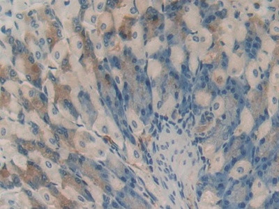 HAO1 Antibody in Immunohistochemistry (Paraffin) (IHC (P))