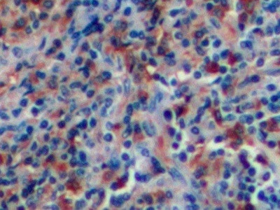 Human IgG4 Antibody in Immunohistochemistry (Paraffin) (IHC (P))