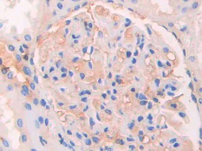 Human IgG4 Antibody in Immunohistochemistry (Paraffin) (IHC (P))