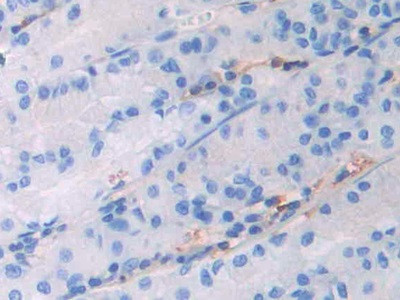 Human IgG4 Antibody in Immunohistochemistry (Paraffin) (IHC (P))