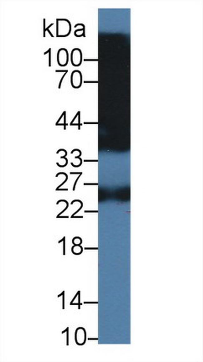 Human IgG4 Antibody in Western Blot (WB)