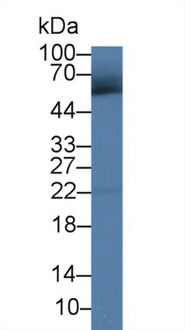 Human IgG4 Antibody in Western Blot (WB)