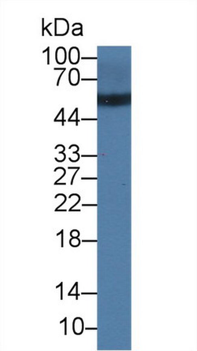 Human IgG4 Antibody in Western Blot (WB)