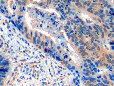 CD275 (B7-H2) Antibody in Immunohistochemistry (Paraffin) (IHC (P))