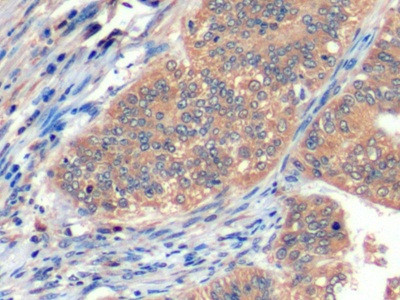 CD275 (B7-H2) Antibody in Immunohistochemistry (Paraffin) (IHC (P))