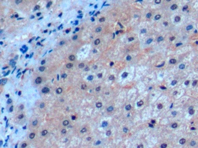 CD275 (B7-H2) Antibody in Immunohistochemistry (Paraffin) (IHC (P))