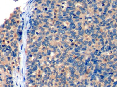 CD275 (B7-H2) Antibody in Immunohistochemistry (Paraffin) (IHC (P))