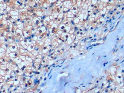 CD275 (B7-H2) Antibody in Immunohistochemistry (Paraffin) (IHC (P))