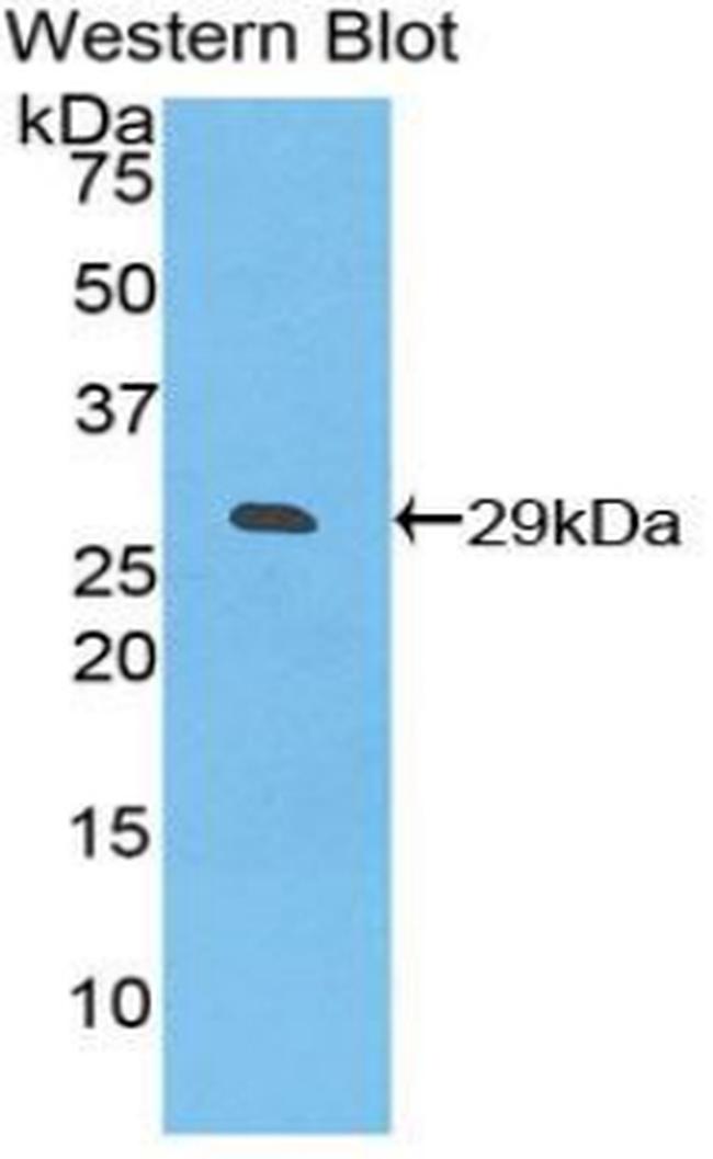 CD275 (B7-H2) Antibody in Western Blot (WB)