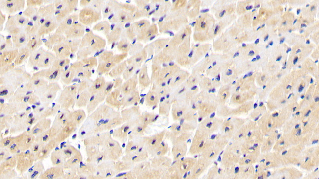 INPP4A Antibody in Immunohistochemistry (Paraffin) (IHC (P))