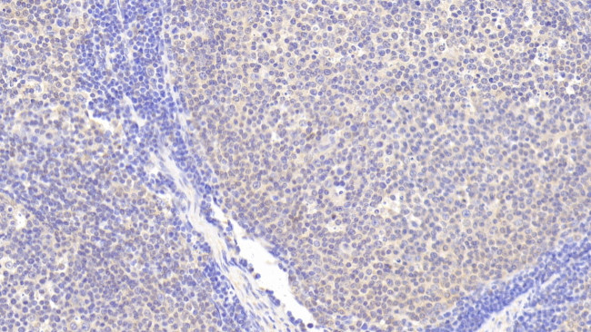 INPP4A Antibody in Immunohistochemistry (Paraffin) (IHC (P))