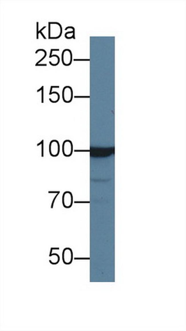 INPP4A Antibody in Western Blot (WB)