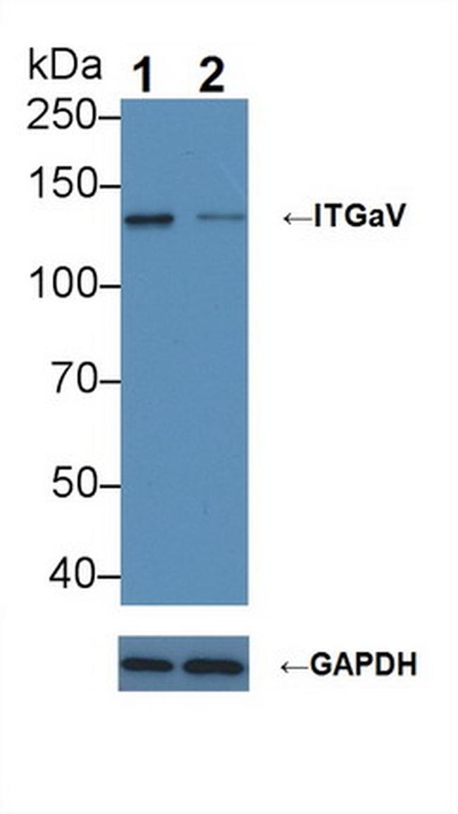 CD51 Antibody in Western Blot (WB)