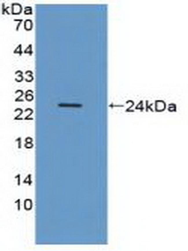 CD51 Antibody in Western Blot (WB)