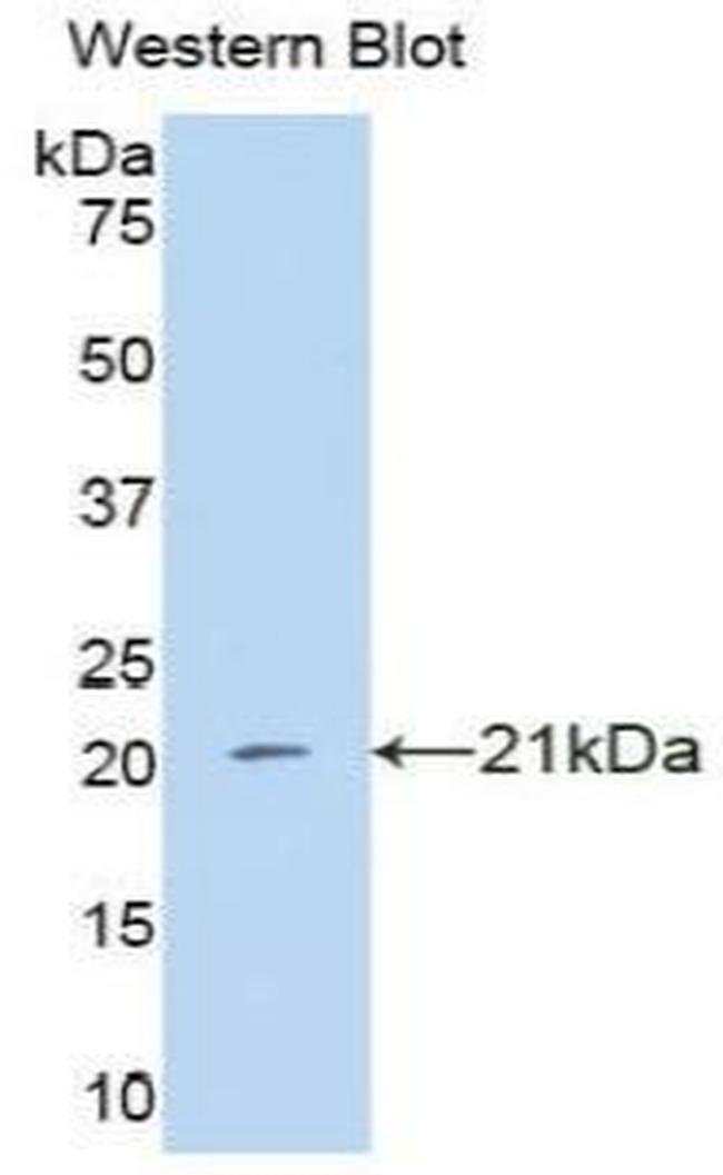 IFNA4 Antibody in Western Blot (WB)