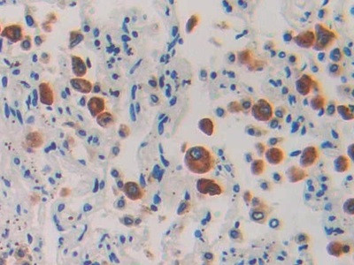 IL-1RAcP Antibody in Immunohistochemistry (Paraffin) (IHC (P))