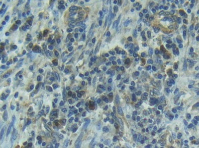 IL1R1 Antibody in Immunohistochemistry (Paraffin) (IHC (P))