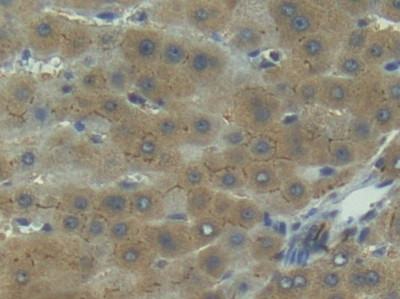 IL1R1 Antibody in Immunohistochemistry (Paraffin) (IHC (P))