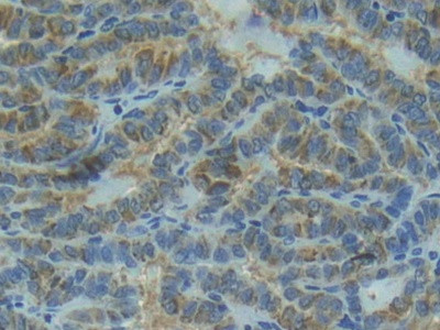 IL1R1 Antibody in Immunohistochemistry (Paraffin) (IHC (P))