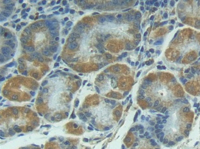 IL1R1 Antibody in Immunohistochemistry (Paraffin) (IHC (P))