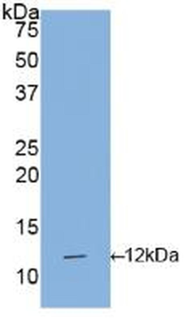 IL1R1 Antibody in Western Blot (WB)