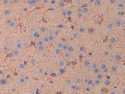 IL11RA Antibody in Immunohistochemistry (Paraffin) (IHC (P))