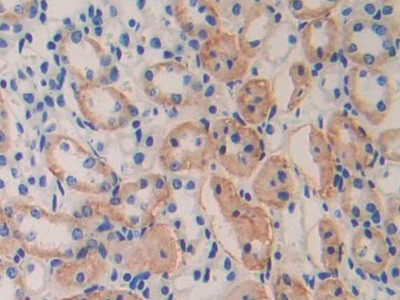 IL11RA Antibody in Immunohistochemistry (Paraffin) (IHC (P))