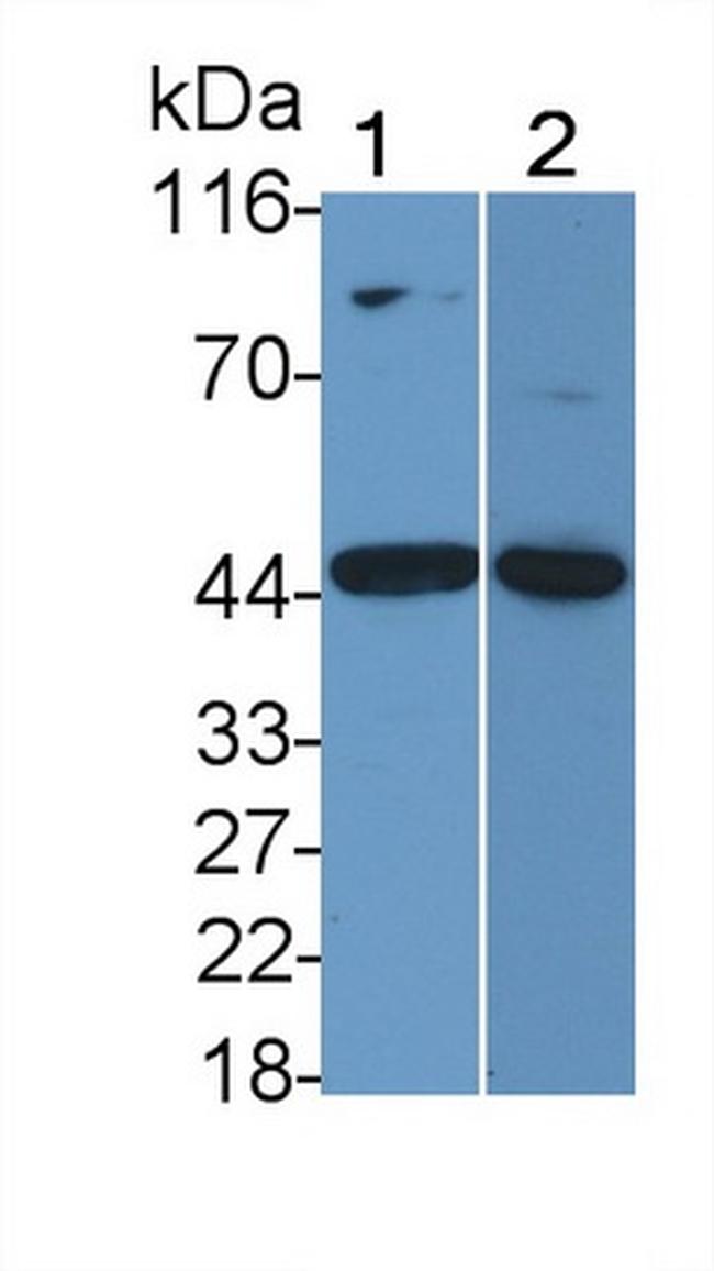 IL11RA Antibody in Western Blot (WB)