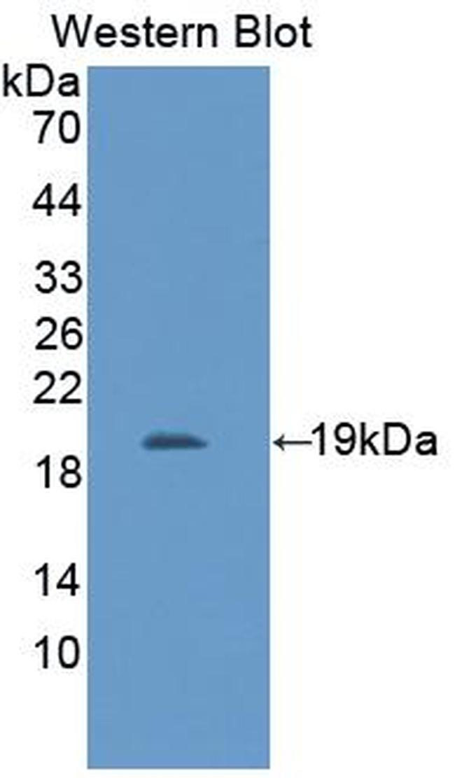 IL11RA Antibody in Western Blot (WB)