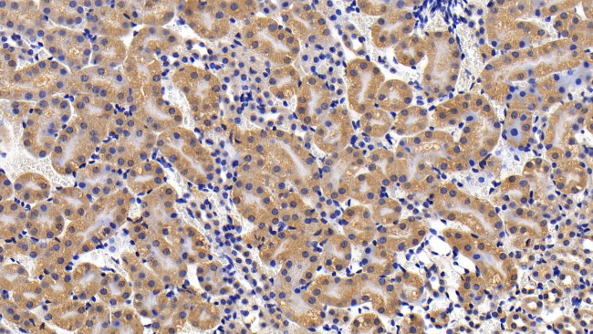 IL11RA Antibody in Immunohistochemistry (Paraffin) (IHC (P))