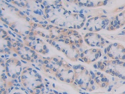 IL11RA Antibody in Immunohistochemistry (Paraffin) (IHC (P))