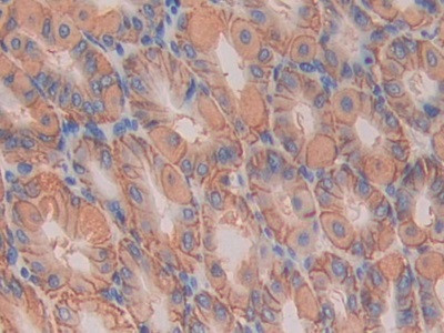 IL11RA Antibody in Immunohistochemistry (Paraffin) (IHC (P))