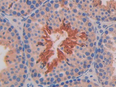 IL11RA Antibody in Immunohistochemistry (Paraffin) (IHC (P))