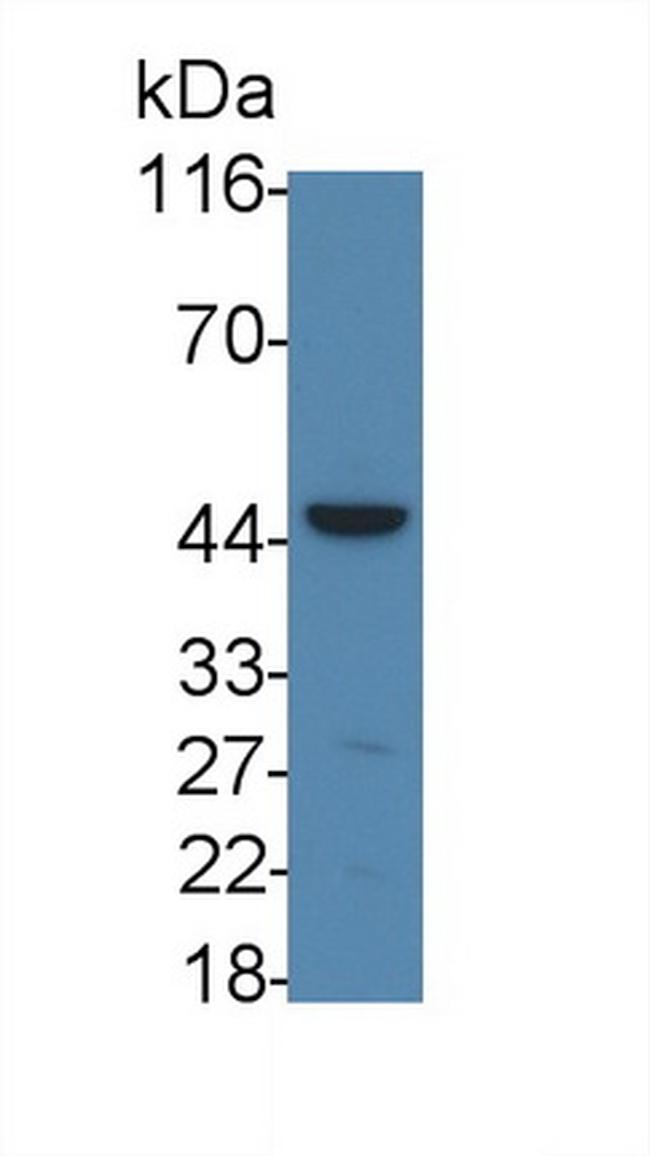 IL11RA Antibody in Western Blot (WB)