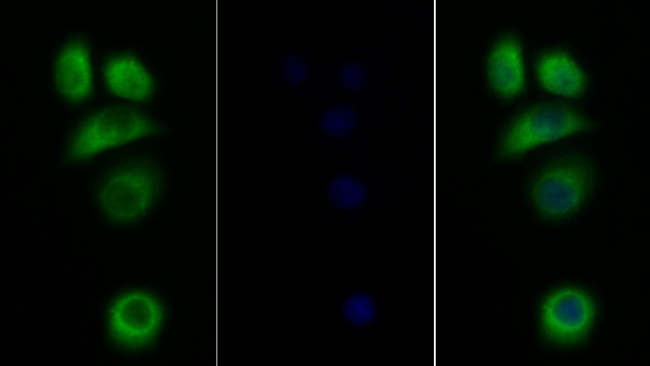 IL31RA Antibody in Immunocytochemistry (ICC/IF)