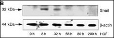 SNAIL Antibody in Western Blot (WB)